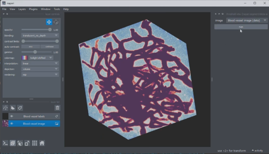 Rago - 3D Vessel Segmentation